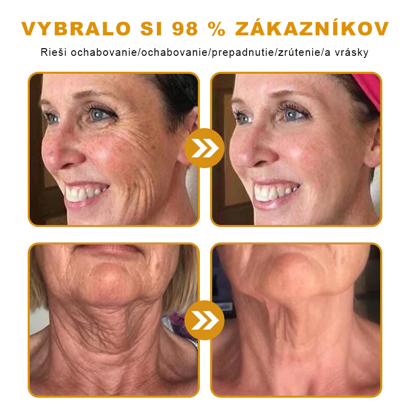 ☁️☁️☁️Sinvie® regeneračný krém s včelím jedom | 50 ml | Odporúčaný Slovenskou dermatovenerologickou spoločnosťou