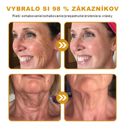 ☁️☁️☁️Sinvie® regeneračný krém s včelím jedom | 50 ml | Odporúčaný Slovenskou dermatovenerologickou spoločnosťou