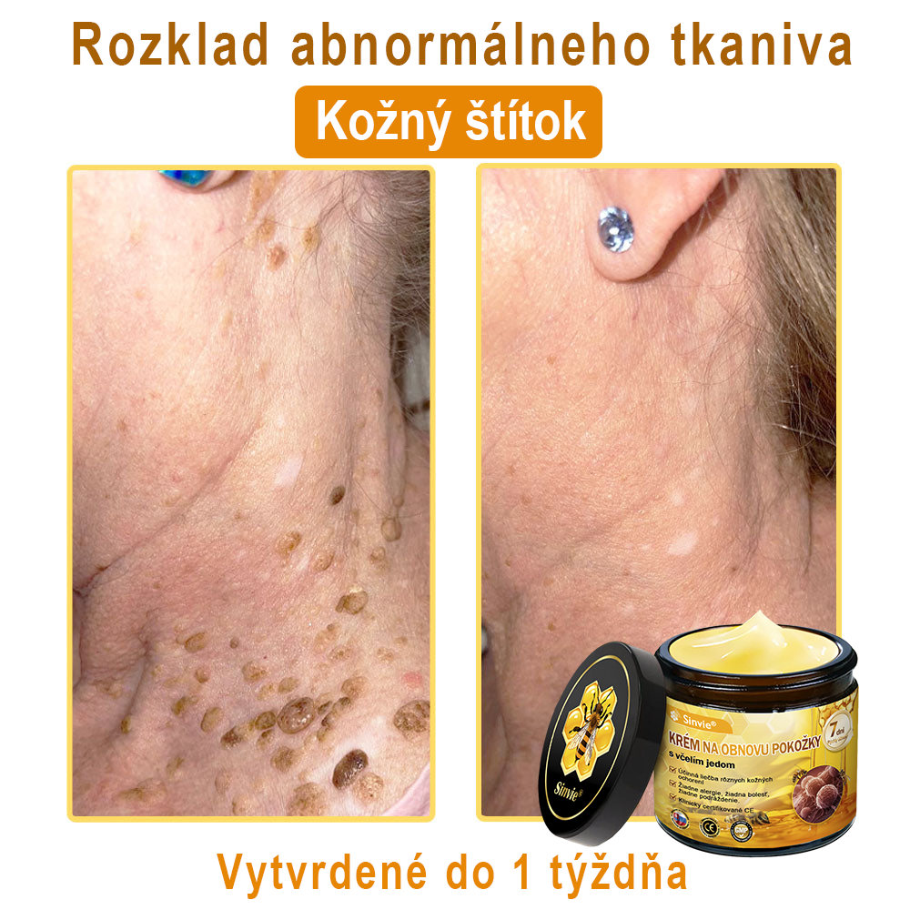☁️☁️☁️Sinvie® regeneračný krém s včelím jedom | 50 ml | Odporúčaný Slovenskou dermatovenerologickou spoločnosťou
