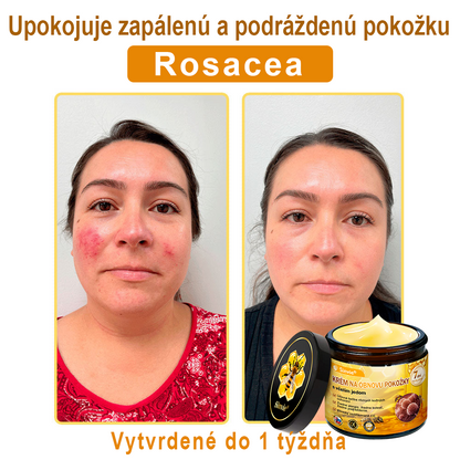 ☁️☁️☁️Sinvie® regeneračný krém s včelím jedom | 50 ml | Odporúčaný Slovenskou dermatovenerologickou spoločnosťou