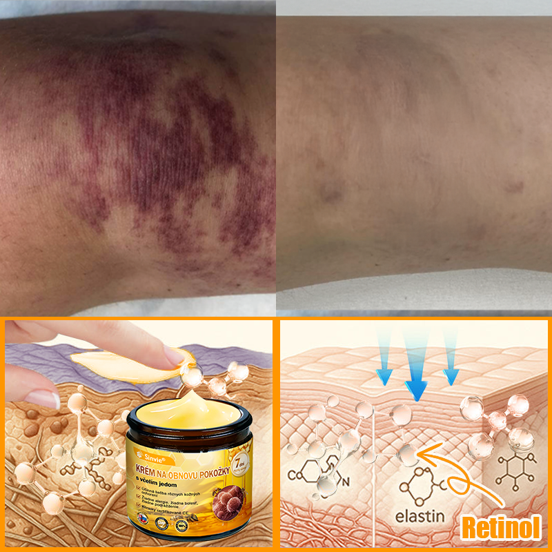 ☁️☁️☁️Sinvie® regeneračný krém s včelím jedom | 50 ml | Odporúčaný Slovenskou dermatovenerologickou spoločnosťou