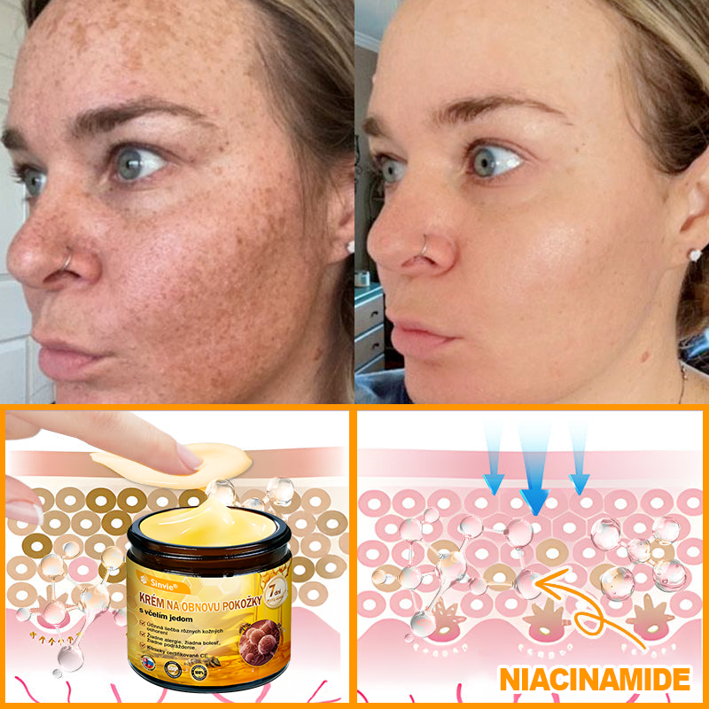 ☁️☁️☁️Sinvie® regeneračný krém s včelím jedom | 50 ml | Odporúčaný Slovenskou dermatovenerologickou spoločnosťou