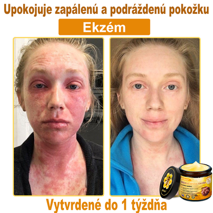 ☁️☁️☁️Sinvie® regeneračný krém s včelím jedom | 50 ml | Odporúčaný Slovenskou dermatovenerologickou spoločnosťou