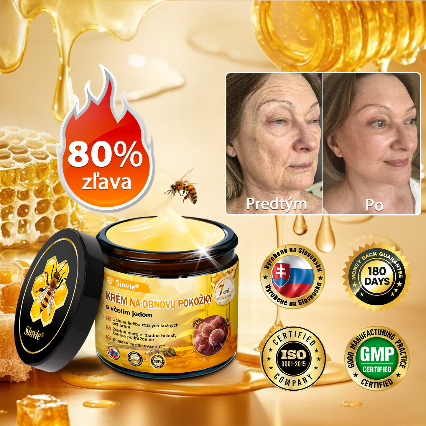 ☁️☁️☁️Sinvie® regeneračný krém s včelím jedom | 50 ml | Odporúčaný Slovenskou dermatovenerologickou spoločnosťou