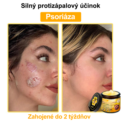 ☁️☁️☁️Sinvie® regeneračný krém s včelím jedom | 50 ml | Odporúčaný Slovenskou dermatovenerologickou spoločnosťou