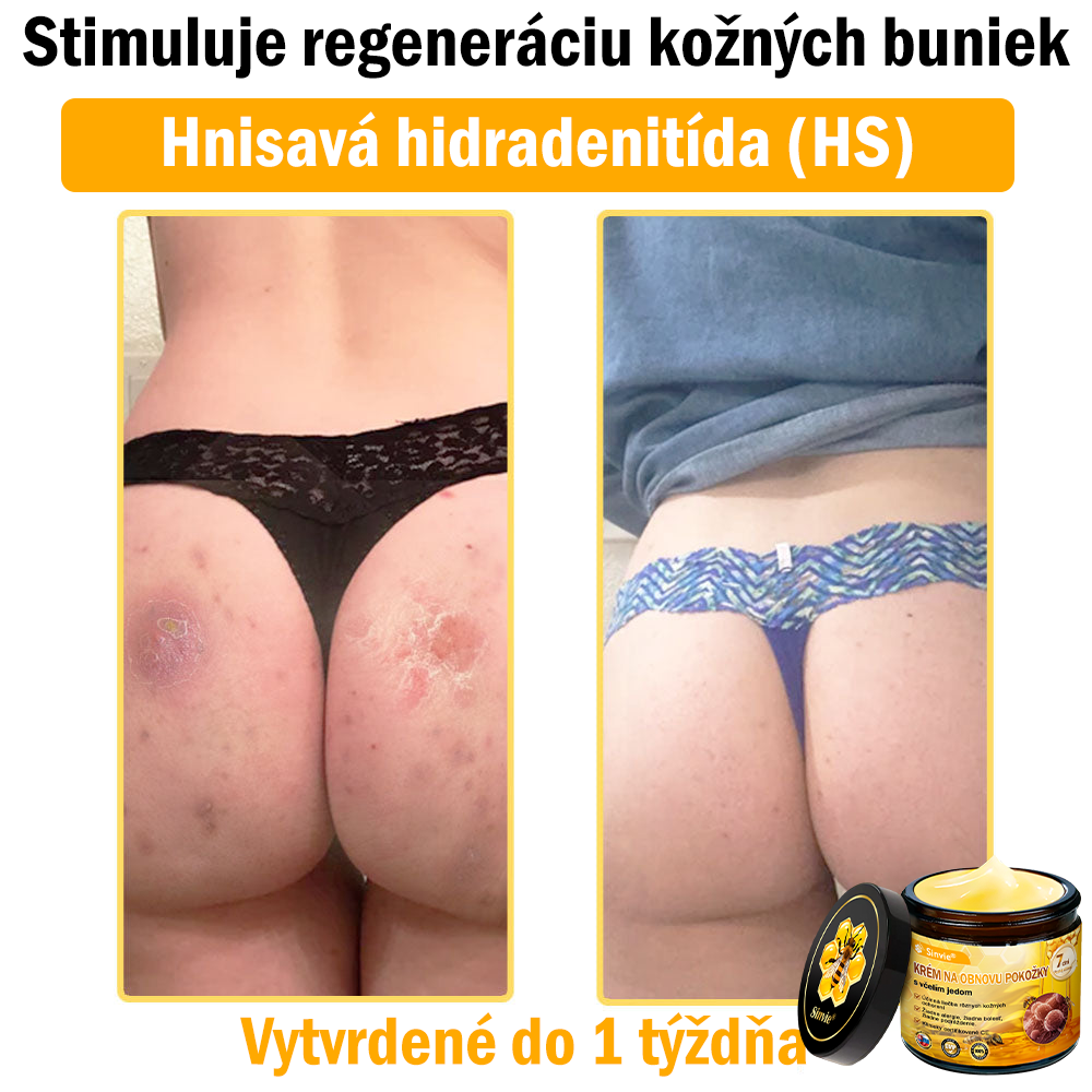 ☁️☁️☁️Sinvie® regeneračný krém s včelím jedom | 50 ml | Odporúčaný Slovenskou dermatovenerologickou spoločnosťou